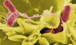 Salmonella Enfeksiyonu Dikkat Edilmediğinde Ölümcül Olabilir