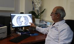 Elektronik sigaranın akciğerde yol açtığı hasar yoğun bakımla sonuçlanıyor