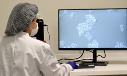 Türkiye'de kan kanseri hastaları için 'hücre' tedavisi dönemi başladı