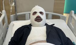 Hararet yapan araca acele müdahale ikinci derece yanığa neden oldu