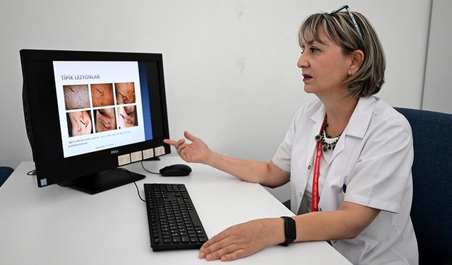 Derideki Ağrılı Nodüller "Köpek Memesi Hastalığı"nın Belirtisi Olabilir