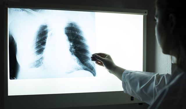 Sigara kullanan 45 yaş üzeri 4 kişiden birinde KOAH ortaya çıkıyor