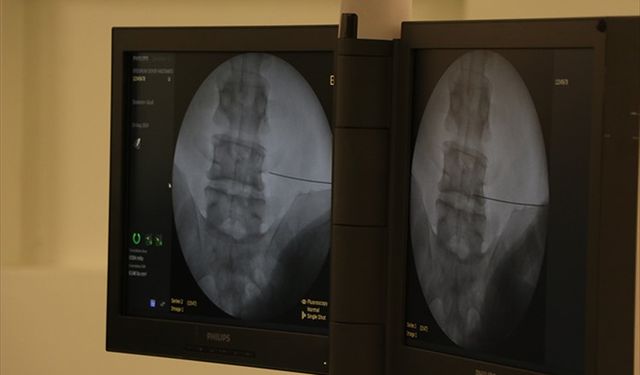 Fıtıkla uzun süre yaşamak ciddi risklere neden olabiliyor