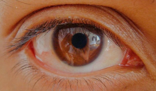 Göz tansiyonunda erken teşhis kalıcı körlüğün önüne geçiyor