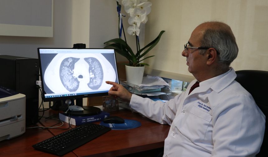 Elektronik sigaranın akciğerde yol açtığı hasar yoğun bakımla sonuçlanıyor