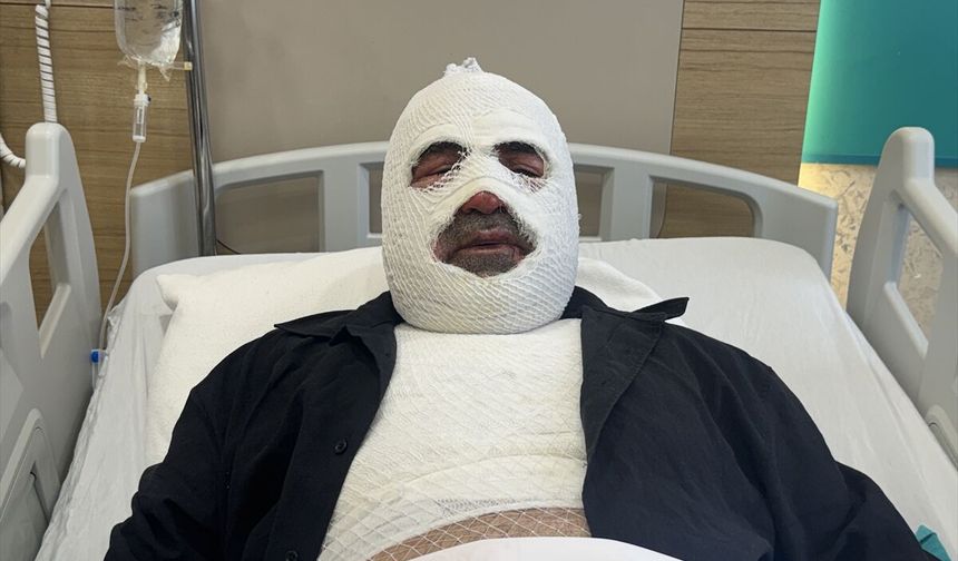 Hararet yapan araca acele müdahale ikinci derece yanığa neden oldu
